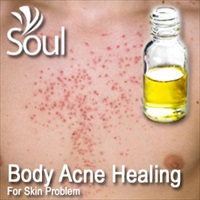 Essential Oil Body Acne Healing - 50ml - Click Image to Close